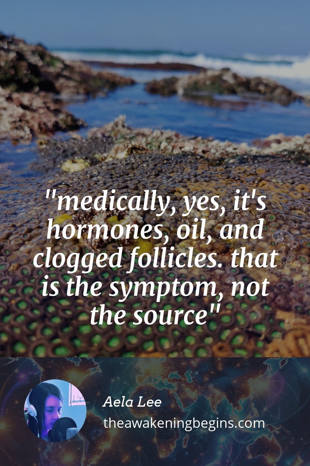 Pinterst Image medically, yes, it's hormones, oil, and clogged follicles. that is the symptom, not the source